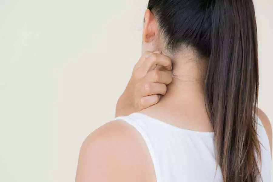 Photo of अगर आप भी हैं खुजली से हैं परेशान, तो जरुर अपनाए ये तरीका