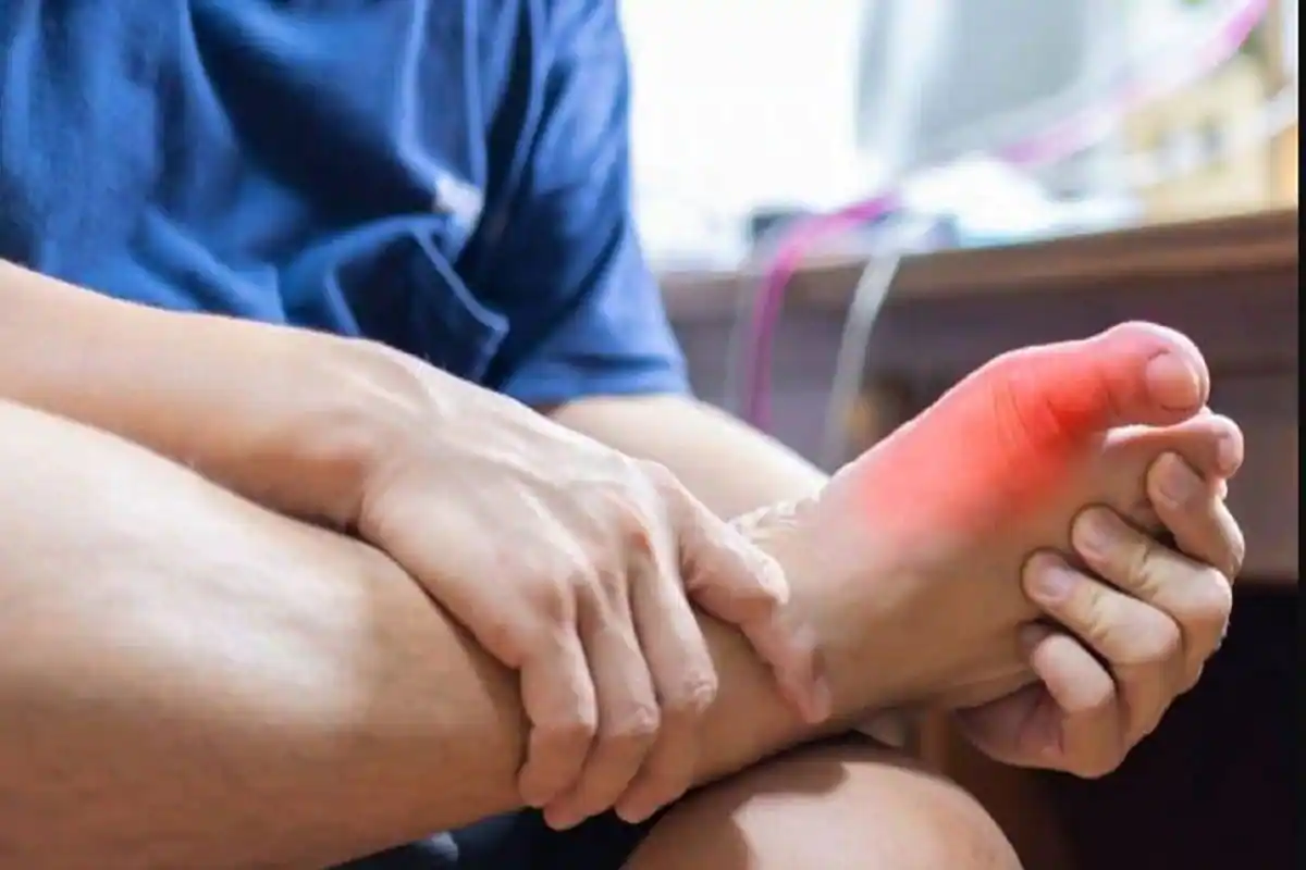 Photo of यूरिक एसिड बढ़ने पर दिखते हैं ये लक्षण