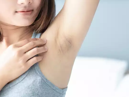 Photo of अंडरआर्म्स के कालेपन को दूर करने के लिए ,जानें कुछ आसान उपाय