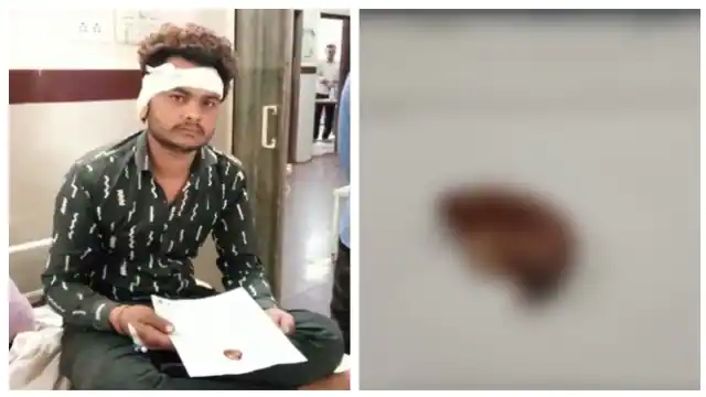 Photo of MP में इस युवक के साथ घर में घुसकर तीन लोगों ने की मारपीट, अगले दिन घर के बाहर फेंका