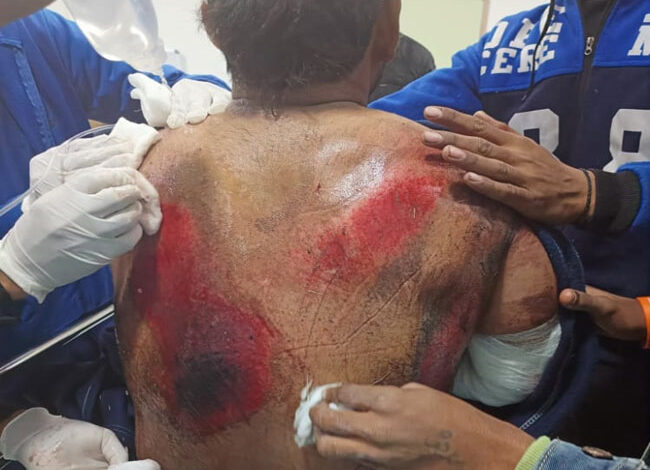 Photo of भारतीय क्रिकेटर ऋष‍भ पंत की कार का  रुड़की में भीषण हादसे का शिकार..