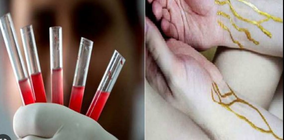 Photo of जानिए इस ब्लड की खासियत जिसकी एक-एक बूंद सोने से भी ज्यादा महंगी…