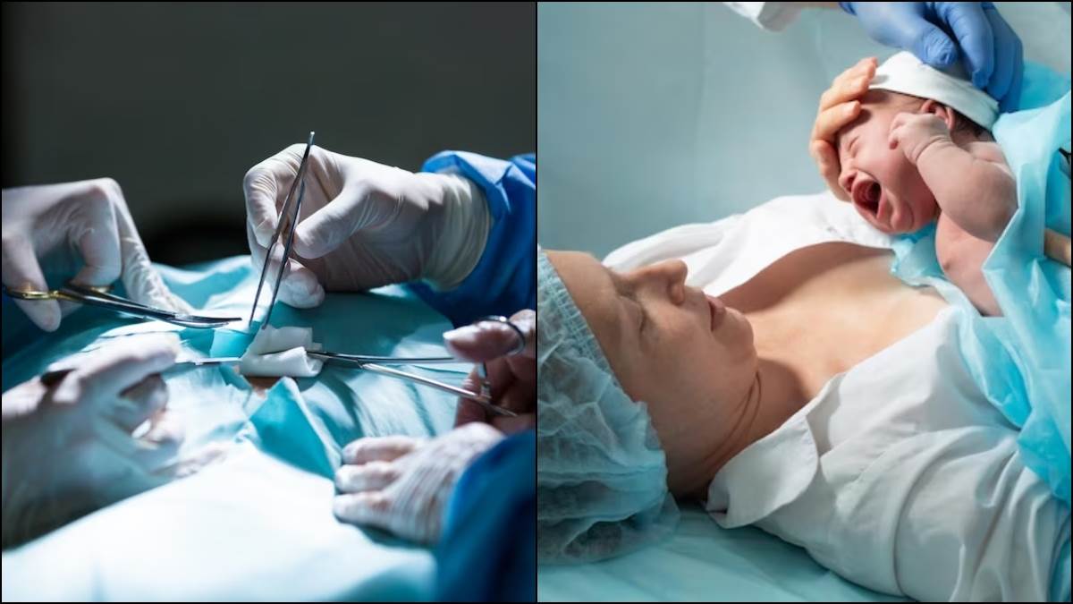 Photo of तो चलिए जानते हैं सी-सेक्शन से जुड़े कुछ आम मिथक और उनकी सच्चाई के बारे में-