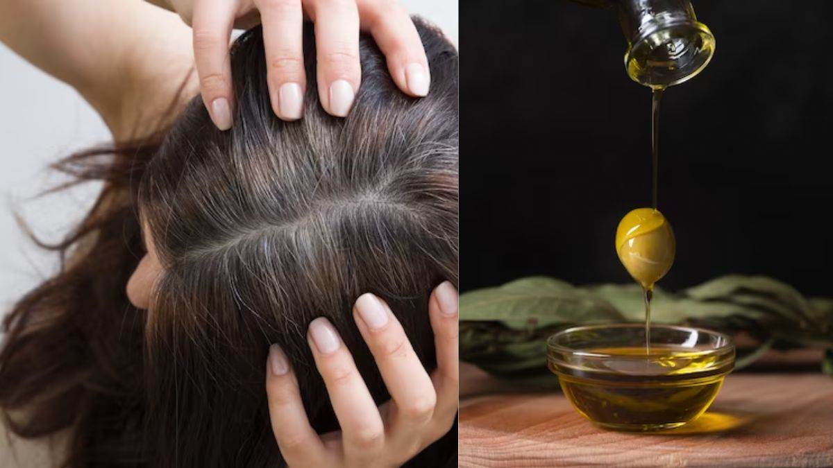 Photo of चाहें तो आप नेचुरल तरीके से भी जुओं की छुट्टी कर सकते हैं…