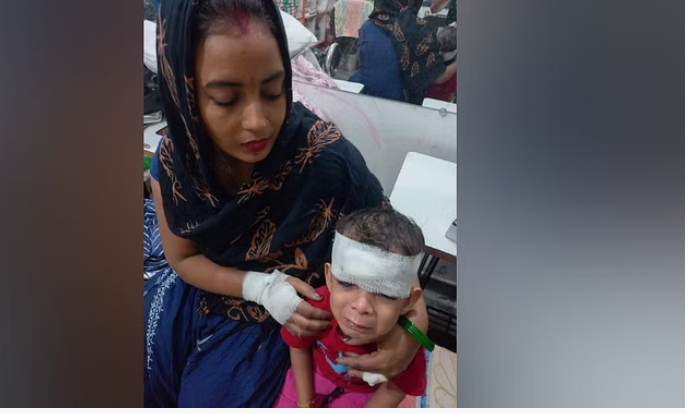 Photo of मां-बेटी पर स्कूल से लौटते समय सांड ने किया जानलेवा हमला