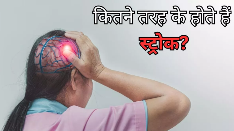 Photo of वर्ल्ड स्ट्रोक डे 2023: तीन तरह के होते हैं स्ट्रोक, जानें इसके लक्षण और कारण