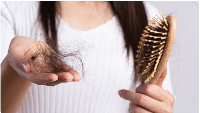 Photo of जानिए क्या बालों के झड़ने का कारण एलोपेसिया एरीटा तो नहीं है?