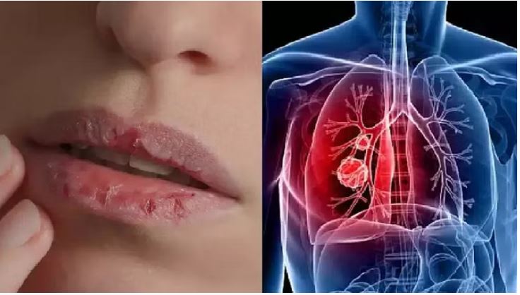 Photo of प्रदूषण से हो रहा निमोनिया…दो की मौत,पढ़े पूरी खबर