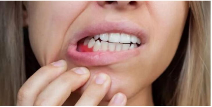 Photo of मसूड़ों से खून आने की समस्या से हैं परेशान, अपनाएं ये आसान टिप्स