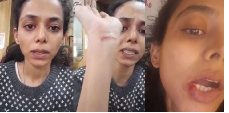 Photo of CID एक्ट्रेस वैष्णवी धनराज के साथ हुई मारपीट