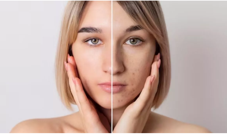 Photo of चेहरे के दाग-धब्बों से छुटकारा पाने के लिए अपनाएं ये आसान घरेलू उपाय