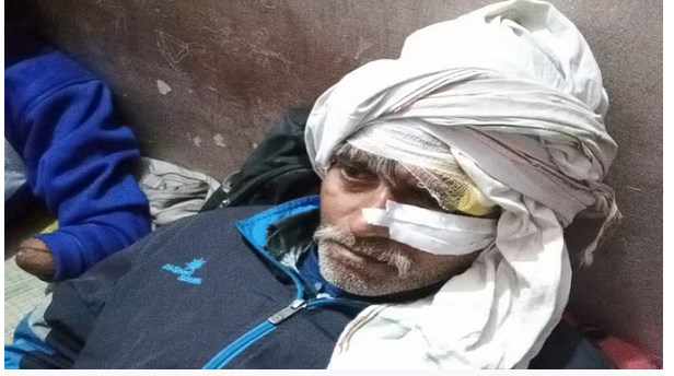 Photo of नोएडा: बदमाशों ने बिजली केंद्र पर बोला धावा, चाकू से कई वार करके लाइनमैन को किया घायल