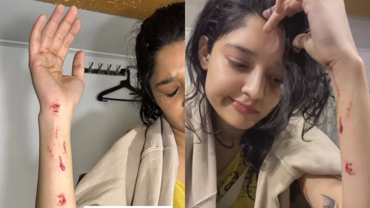 Photo of शूटिंग के दौरान बुरी तरह घायल हुईं रजनीकांत की एक्ट्रेस रितिका सिंह