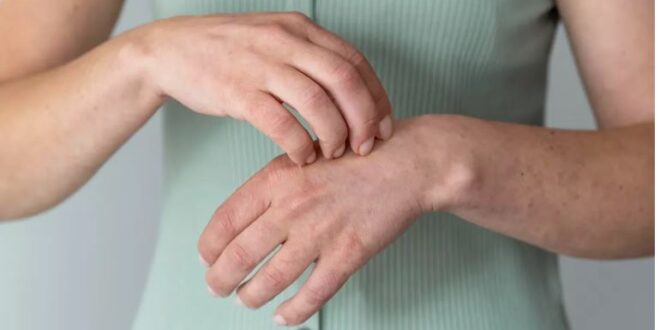 Photo of इन उपायों से पाएं दाद खाज खुजली से राहत