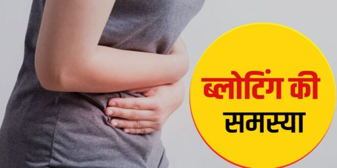 Photo of ब्लोटिंग की समस्या का समाधान है ये नुस्खें
