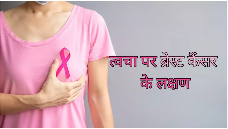 Photo of ब्रेस्ट कैंसर के त्वचा पर नजर आते हैं ये प्रमुख लक्षण