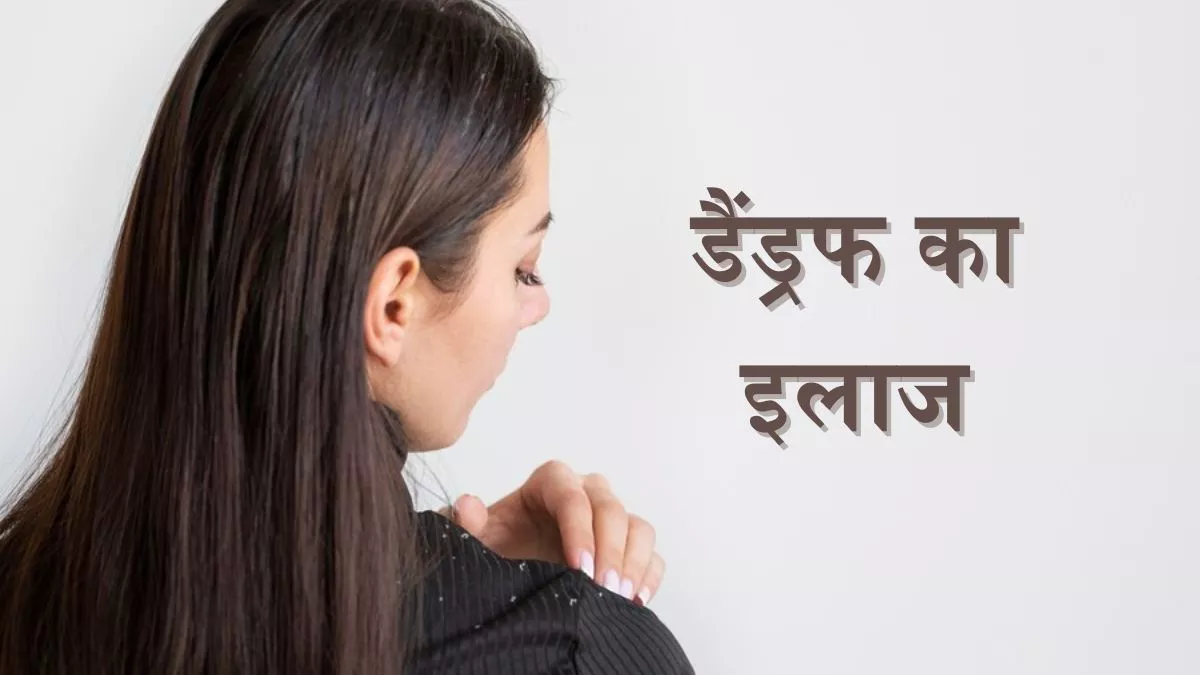 Photo of  डैंड्रफ की समस्या से हैं परेशान, तो कपूर ये है इसका रामबाण इलाज
