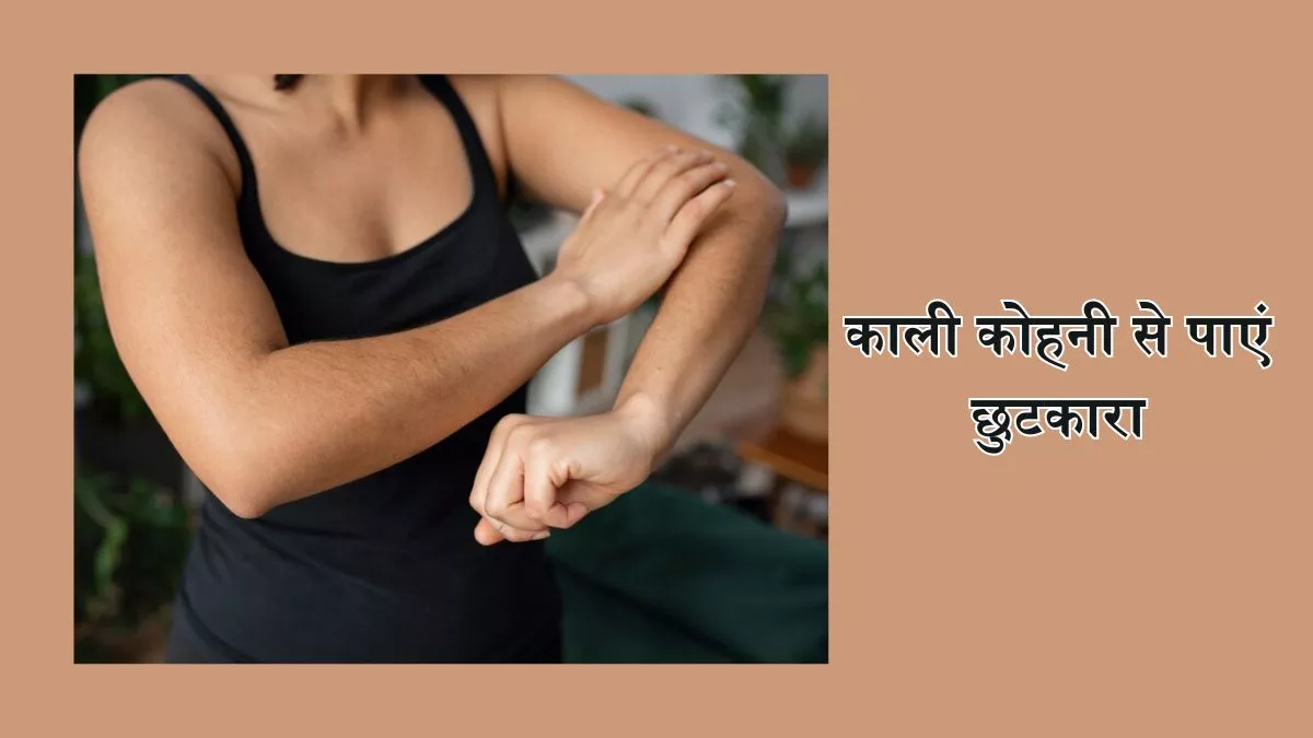 Photo of कोहनी और घुटने दिखने लगे हैं काले, तो इन घरेलू नुस्खों से पाएं चमकदार त्वचा