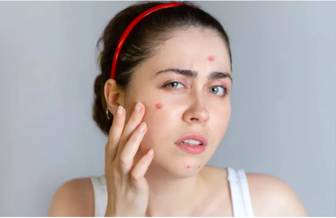 Photo of पिंपल्स को दूर और चेहरे की चमक को बढ़ाते हैं ये होममेड फेस पैक्स