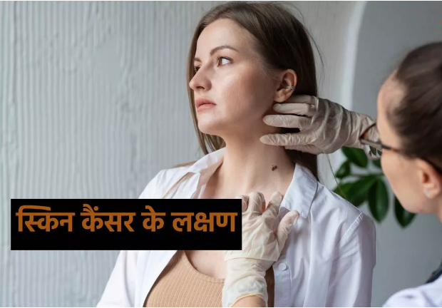 Photo of स्किन कैंसर की ओर इशारा करते हैं त्वचा में होने वाले ये बदलाव