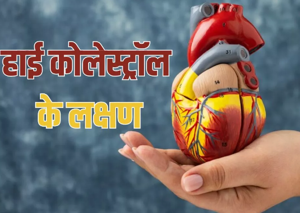 Photo of हार्ट डिजीज को न्यौता दे सकता है High Cholesterol