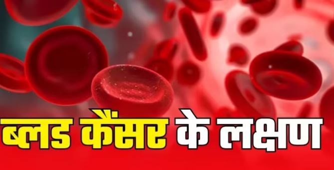 Photo of कैंसर का सबसे गंभीर प्रकार है ब्लड कैंसर, शरीर में नजर आ रहे इन संकेतों को न करें इग्नोर