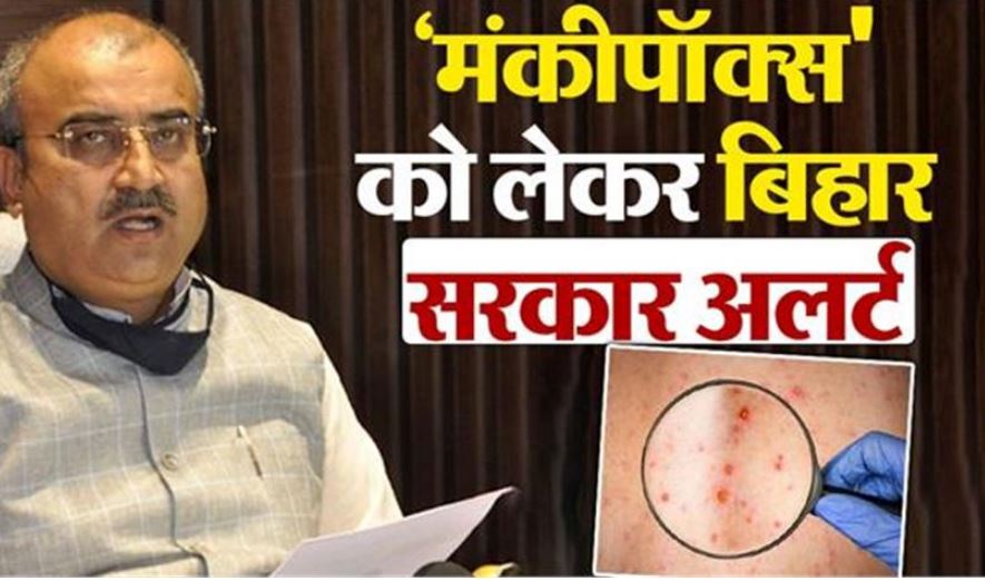 Photo of ‘मंकीपॉक्स’ को लेकर बिहार का स्वास्थ्य विभाग अलर्ट