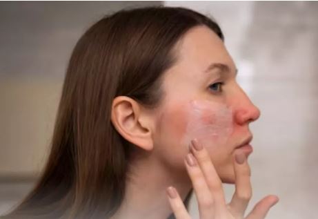 Photo of ड्राई स्किन से बचने के लिए अपनाएं ये स्किन केयर रूटीन