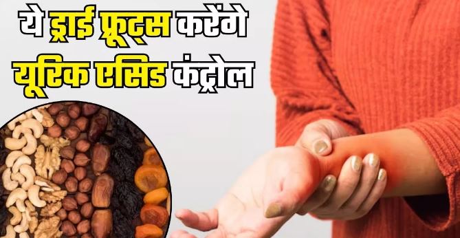 Photo of बढ़ते Uric Acid पर लगाम लगा देंगे ये ड्राई फ्रूट्स