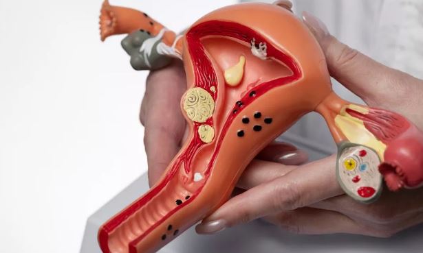 Photo of एक तय समय के बाद मह‍िलाओं में बढ़ जाता है Cervical Cancer का खतरा