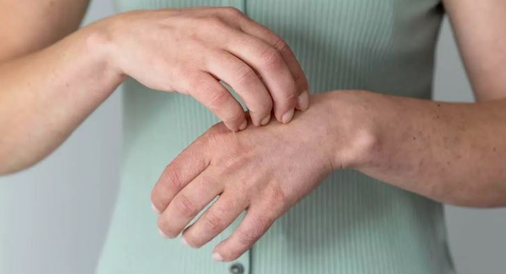 Photo of खुजली करने से बचते हैं आप? नई रिसर्च में हुआ बड़ा खुलासा