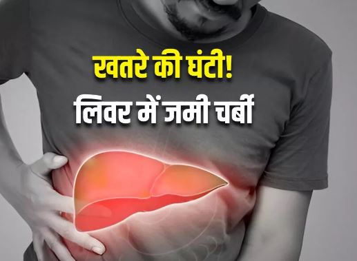 Photo of लिवर की बढ़ती चर्बी हो सकती है जानलेवा