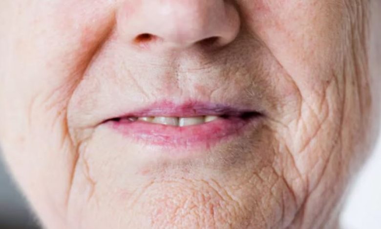 Photo of उम्र से पहले नजर आने लगी हैं झुर्रियां?