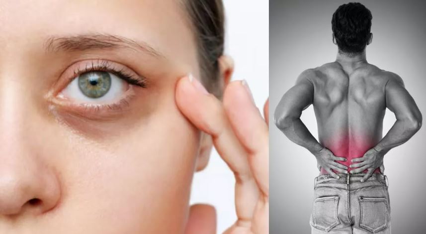 Photo of शरीर में दिखें ये 7 लक्षण तो समझ जाएं कम हो गया है Collagen