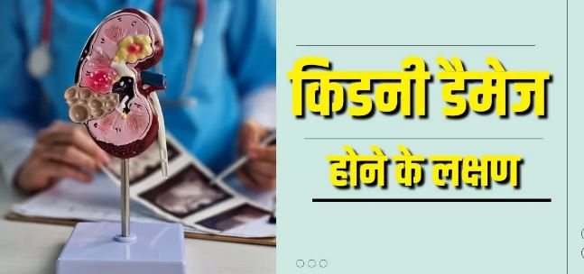 Photo of किडनी खराब होने के इन शुरुआती संकेतों को न करें इग्नोर