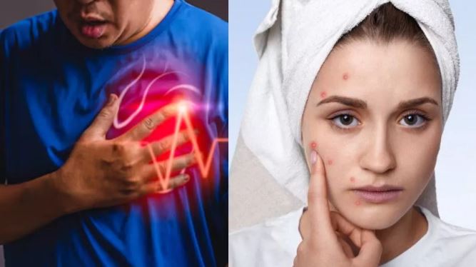 Photo of स्‍क‍िन पर नजर आएं ये 5 लक्षण ताे समझ जाएं बीमार हो गया है आपका Heart