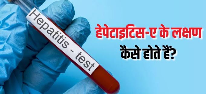 Photo of बारिश के मौसम में क्यों बढ़ जाता है हेपेटाइटिस-ए का खतरा? 