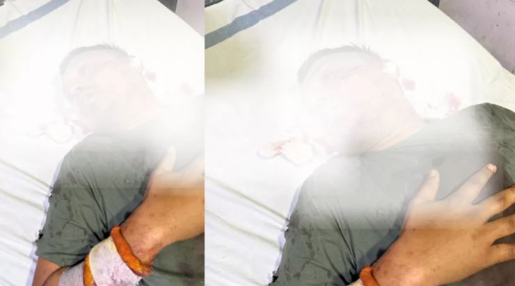 Photo of छत्तीसगढ़: रायपुर सेंट्रल जेल में गैंगवार, कांग्रेस नेता पर हुआ जानलेवा हमला