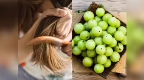Photo of हेयर फॉल रोकने के लिए इन 5 तरीकों से करें आंवले का इस्तेमाल