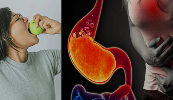 Photo of इन 5 हेल्थ कंडीशन वाले लोगों को नहीं खाना चाहिए अमरूद