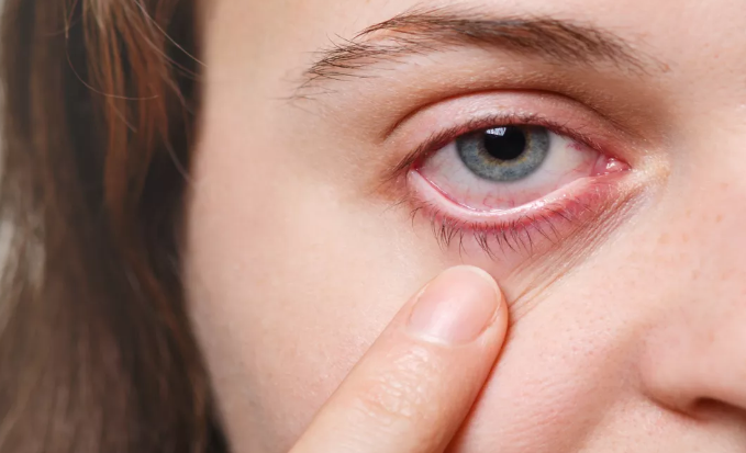 Photo of आंखों में दिखता है हाई ब्लड प्रेशर का पहला संकेत