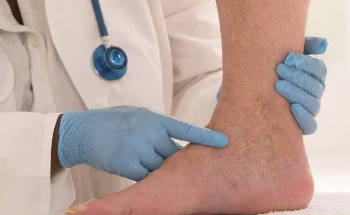 Photo of पैरों में दिखते हैं खराब ब्लड सर्कुलेशन के ये 3 लक्षण