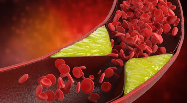 Photo of जीन एडिटिंग थेरेपी से खराब कोलेस्ट्रॉल में आएगी कमी