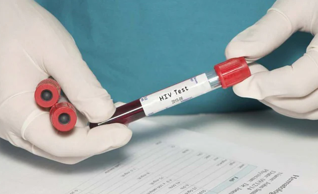 Photo of विश्व एड्स दिवस पर दूर करें इस बीमारी से जुड़ी 3 मिथक