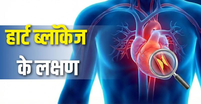 Photo of सीने में दर्द ही नहीं, ये 5 लक्षण भी हैं हार्ट ब्लॉकेज की निशानी