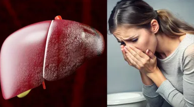 Photo of त्वचा पर नजर आते हैं लिवर की खराबी के 5 लक्षण