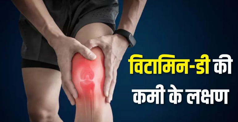Photo of शरीर में चुपके से घर कर रही है विटामिन डी की कमी? इन 5 संकेतों को पहचानें