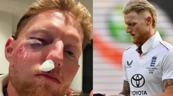Photo of इंग्लैंड के कप्तान बेन स्टोक्स के चेहरे पर लगी भयानक चोट