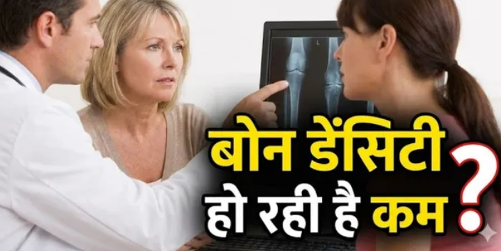 Photo of डाइट और एक्सरसाइज का ये कॉम्बिनेशन बढ़ा देगा बोन डेंसिटी