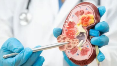 Photo of किडनी डिजीज को साइलेंट किलर क्यों कहा जाता है?